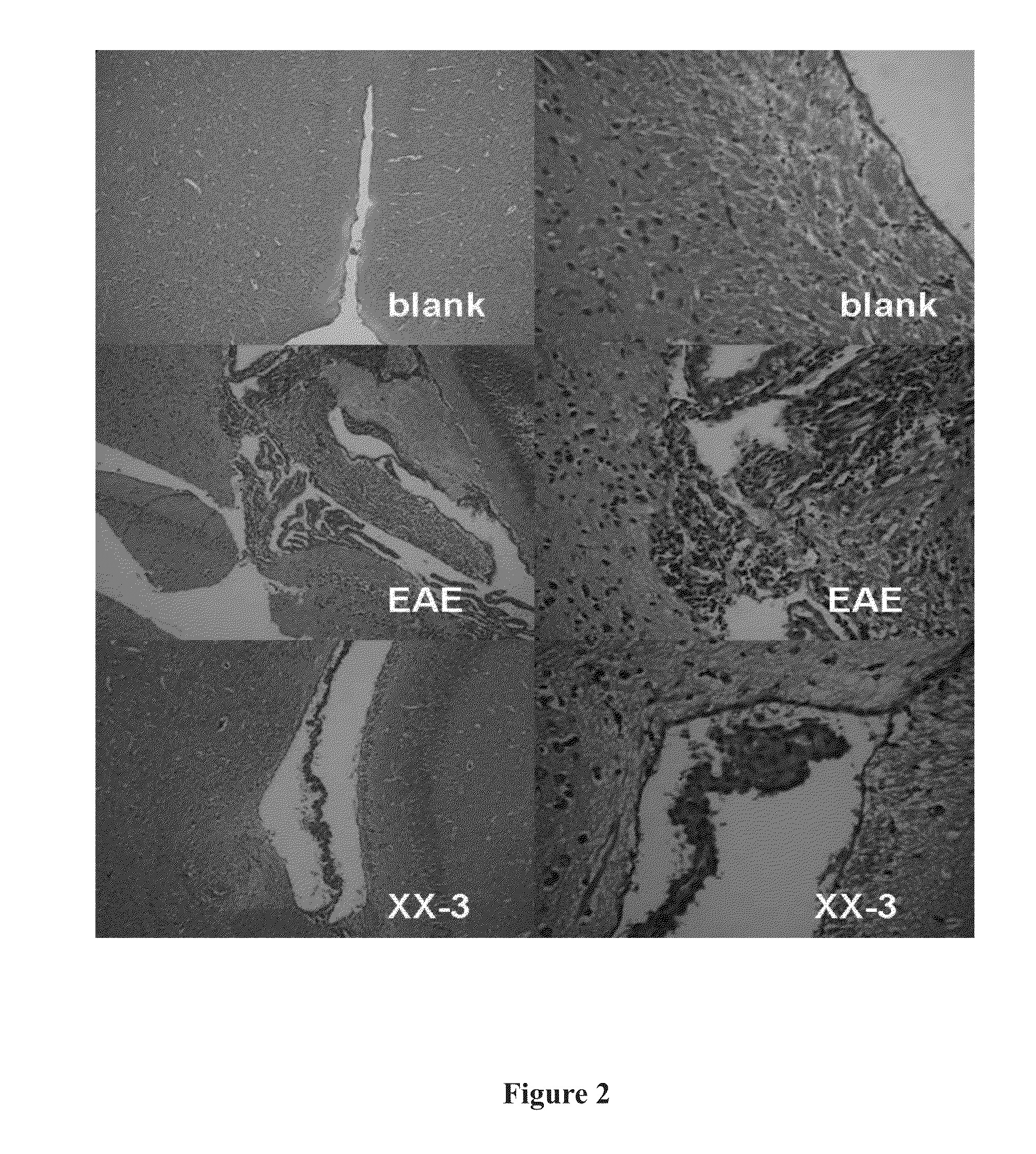 Line leaf inula flower lactone A and methods for preparing and using the same for treating multiple sclerosis