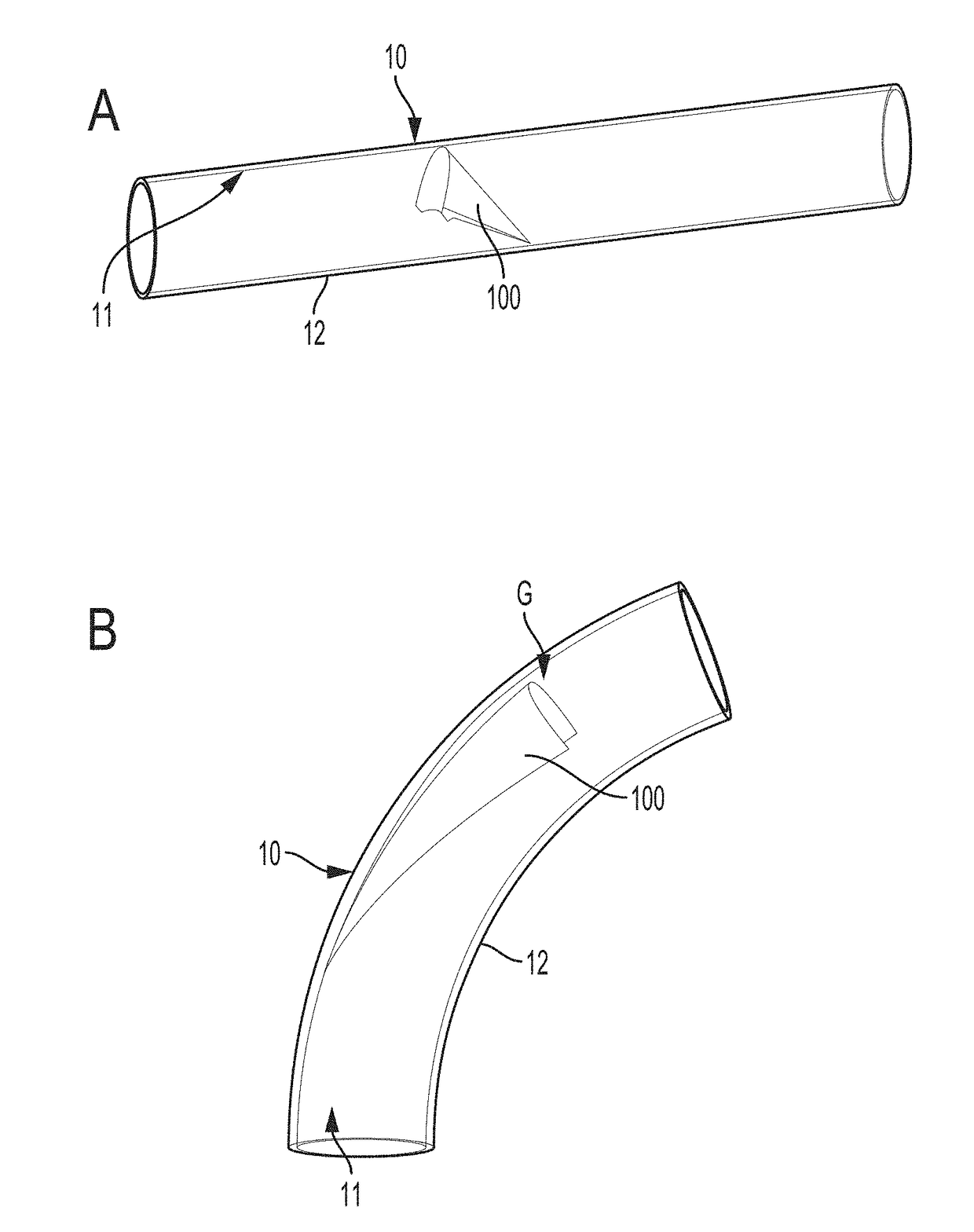 Valved conduit and method for fabricating same