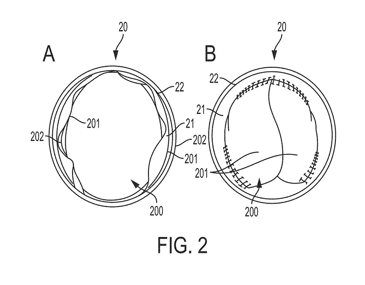 Valved conduit and method for fabricating same