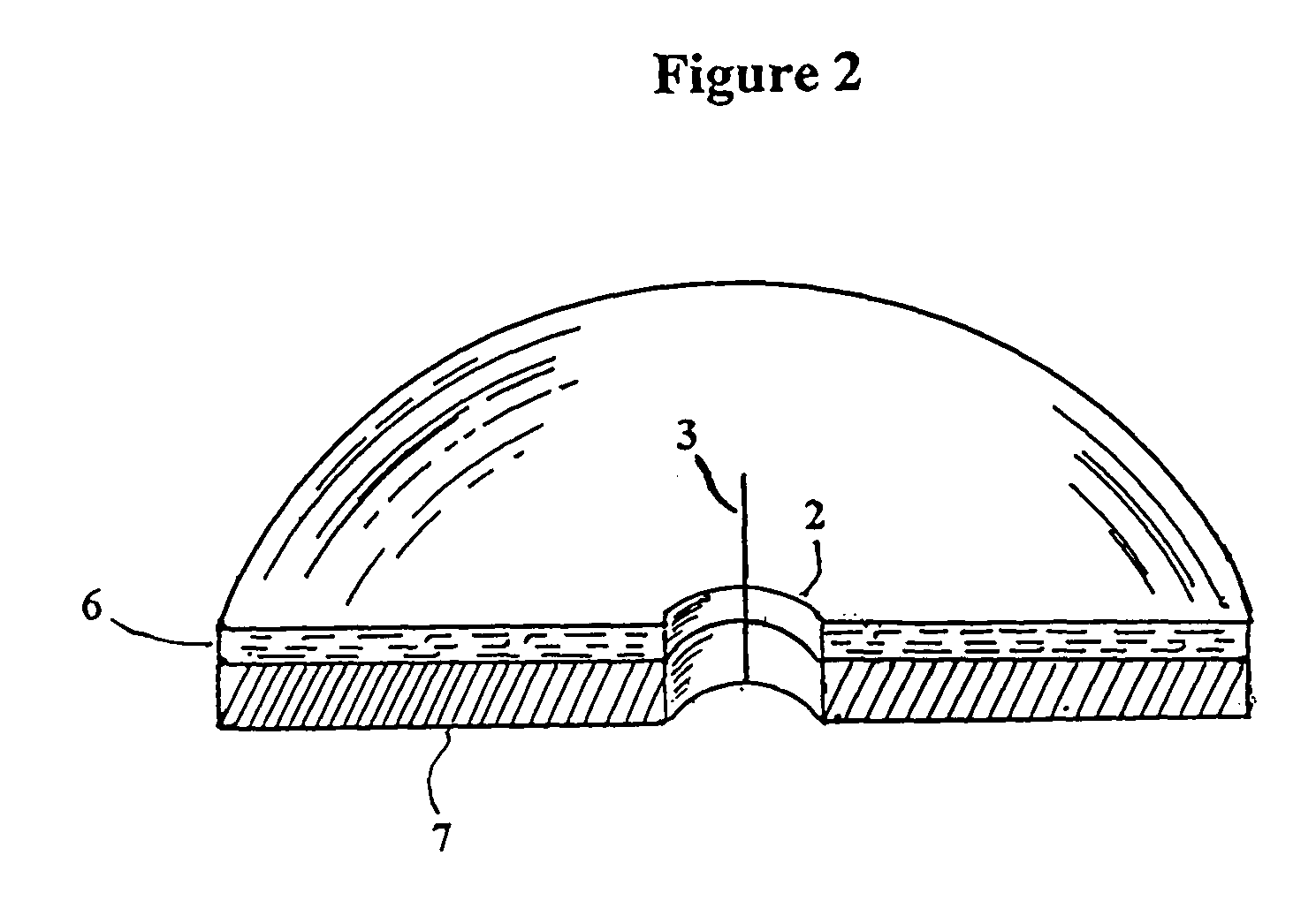 Catheter patch