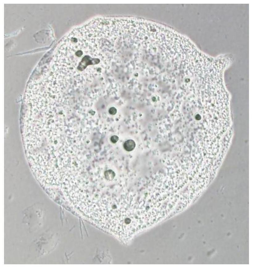 Universal platelet preparation prepared from umbilical cord-derived mesenchymal stem cells and method