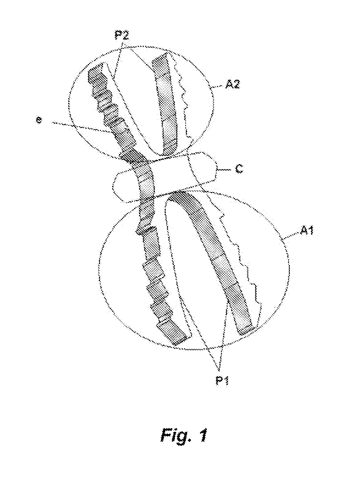 Osteosynthesis device