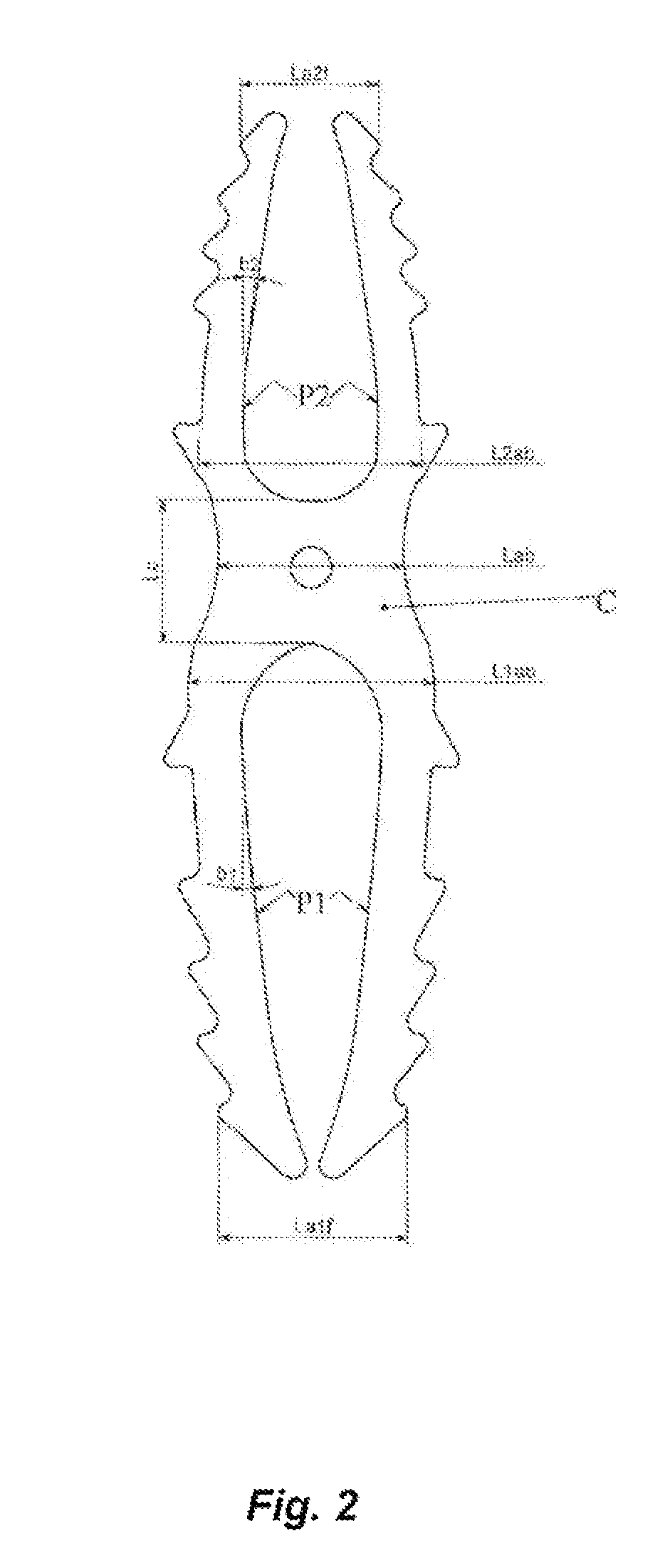 Osteosynthesis device