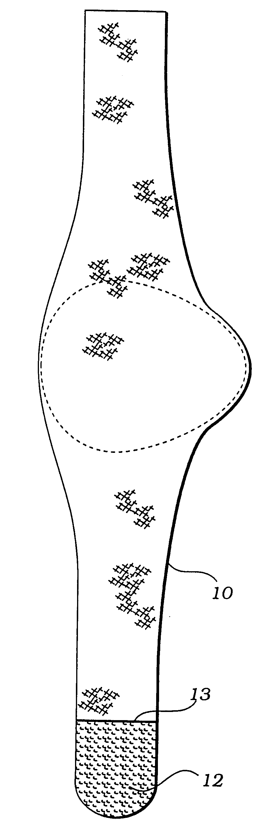 Device for foot stabilization