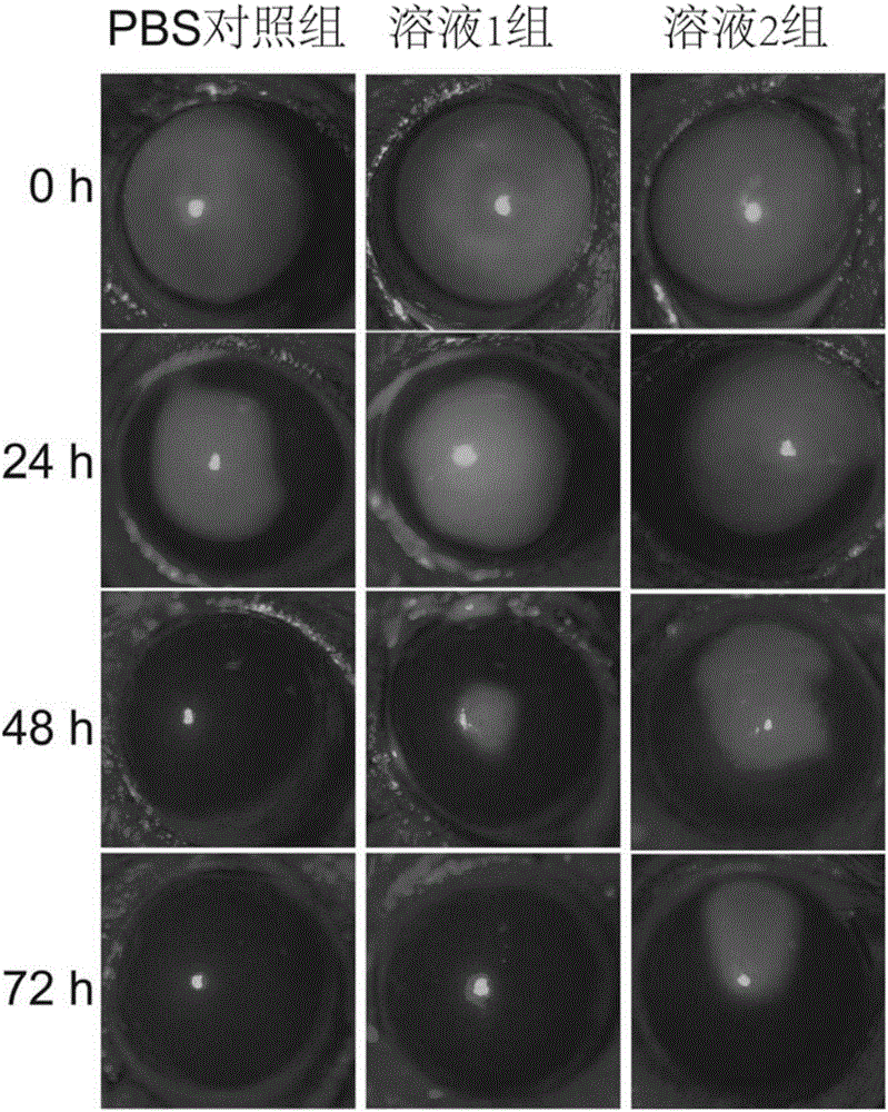 Hydroxytyrosol eye drops for effectively targeting trigeminal ganglion and preparation method thereof