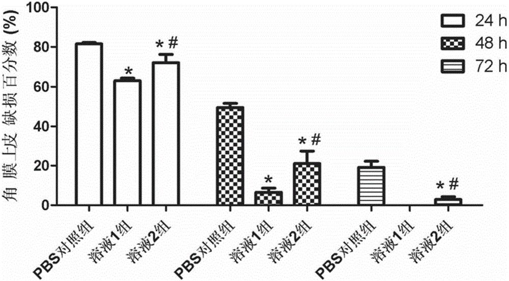 Hydroxytyrosol eye drops for effectively targeting trigeminal ganglion and preparation method thereof