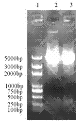 A kind of respiratory syncytial virus f2 protein subunit vaccine and preparation method thereof