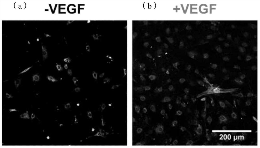 A kind of cardiovascular stent coating based on double-layer heterogeneous structure and preparation method thereof