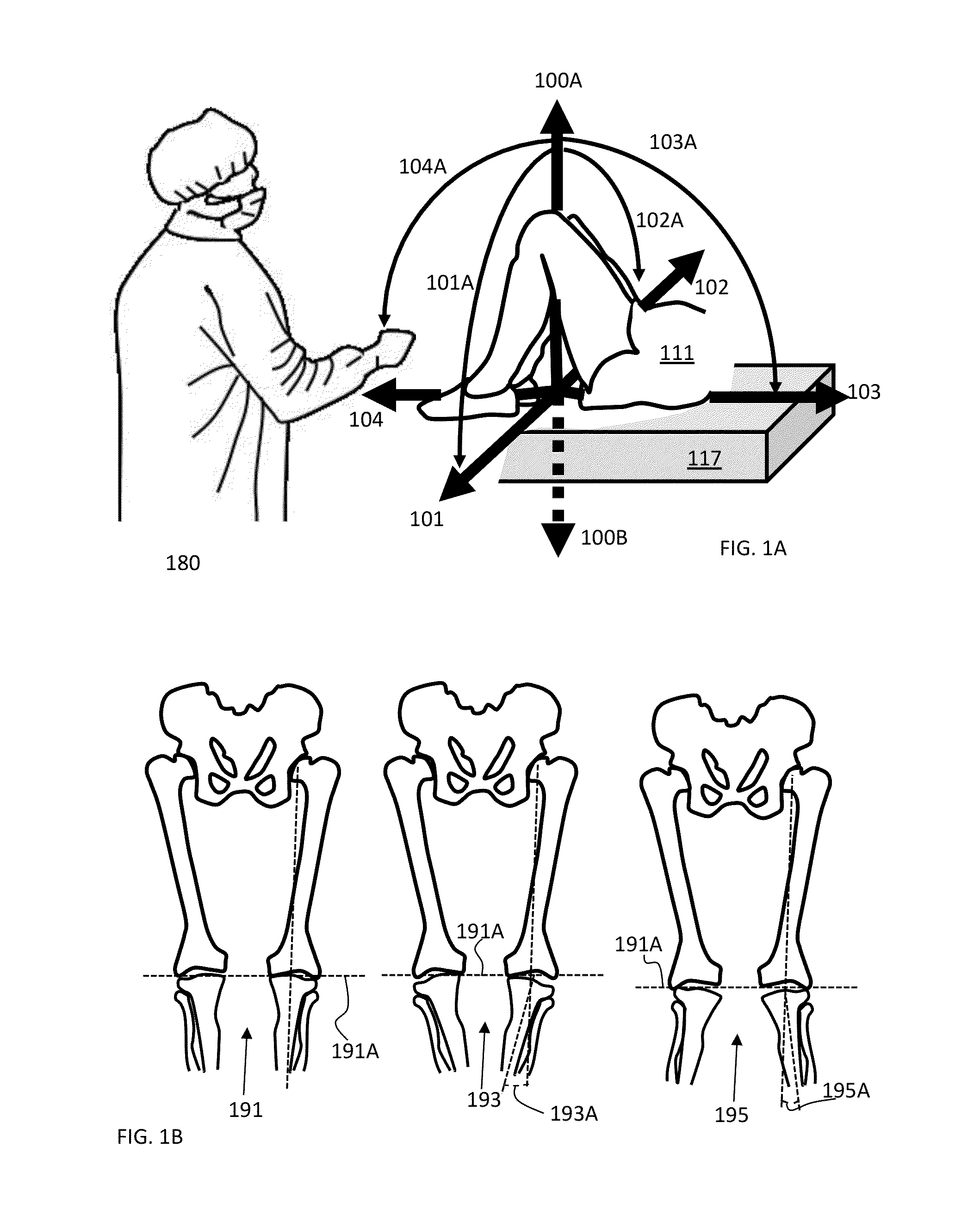 Bone cutting method for alignment relative to a mechanical axis