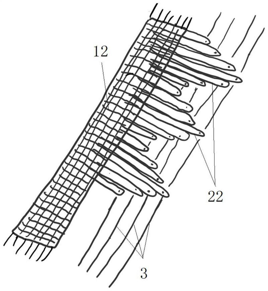 Heart valve prosthesis, artificial valve formed by heart valve prosthesis and preparation method of artificial valve