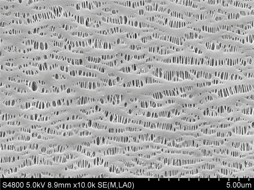 A kind of composite ceramic diaphragm for lithium ion battery and preparation method thereof