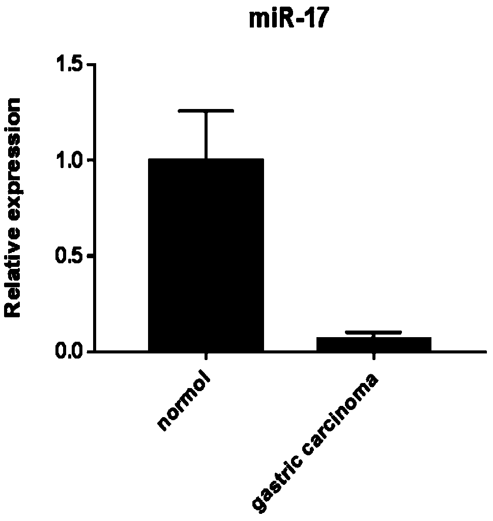 Gastric carcinoma diagnosis kit combining RhoA signal path monitoring with microRNAs (micro Ribonucleic Acids) and application thereof