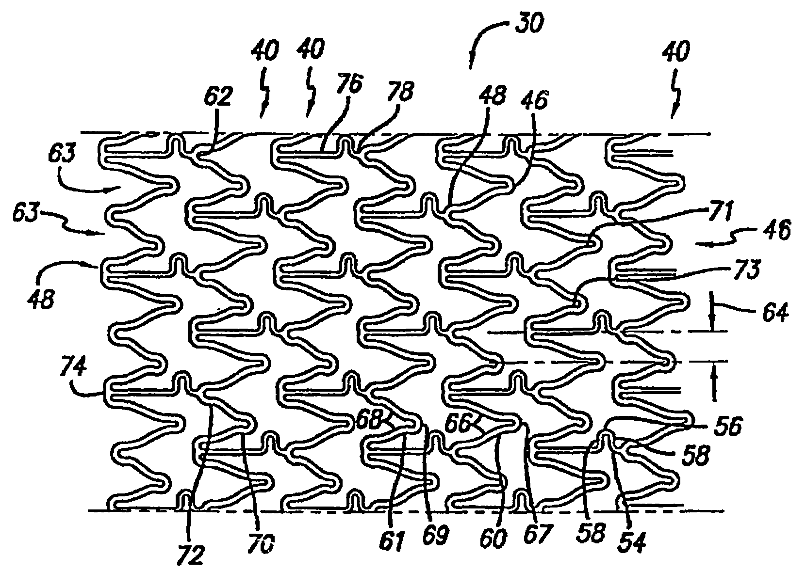 Intravascular stent