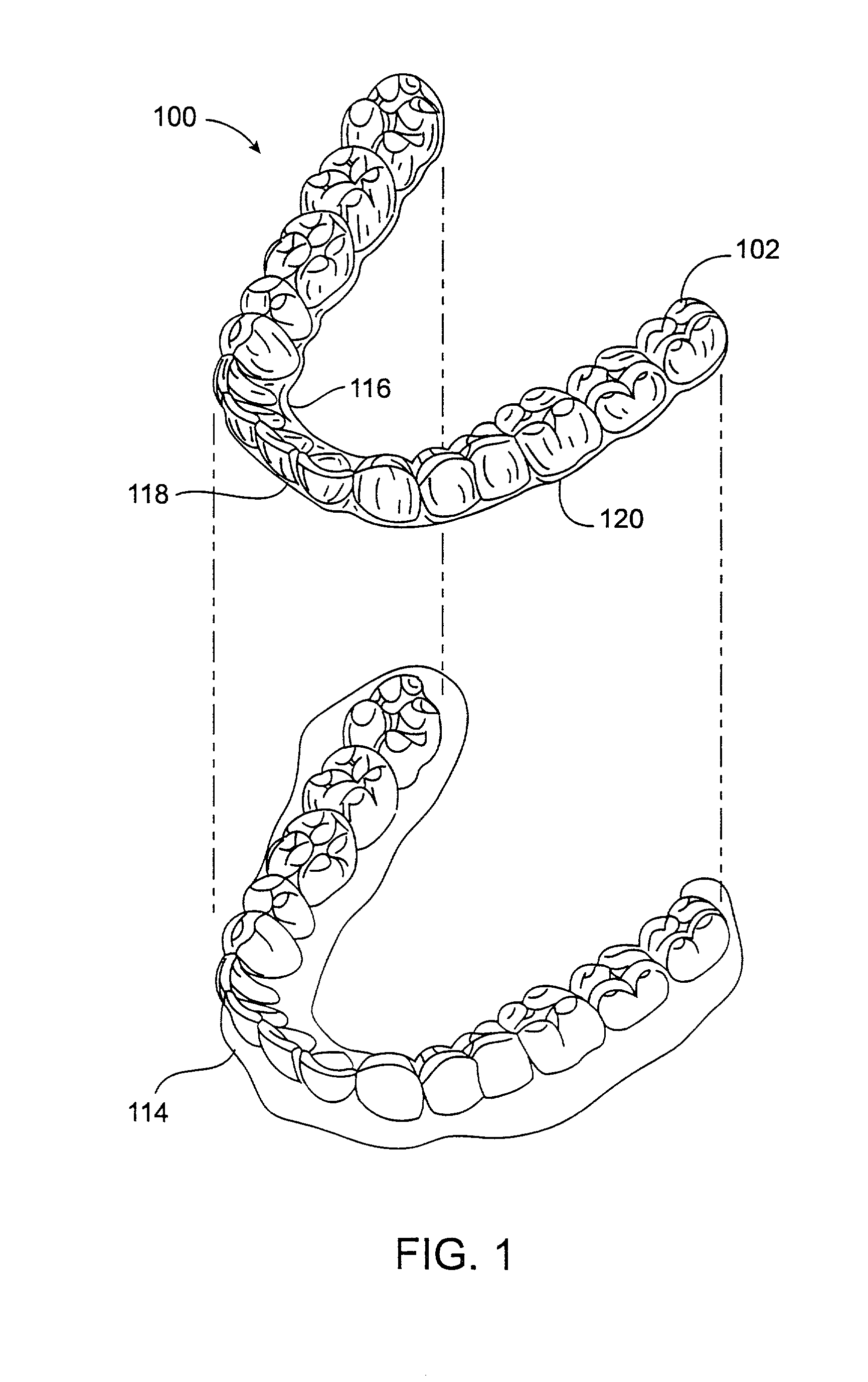 System and method for releasing tooth positioning appliances