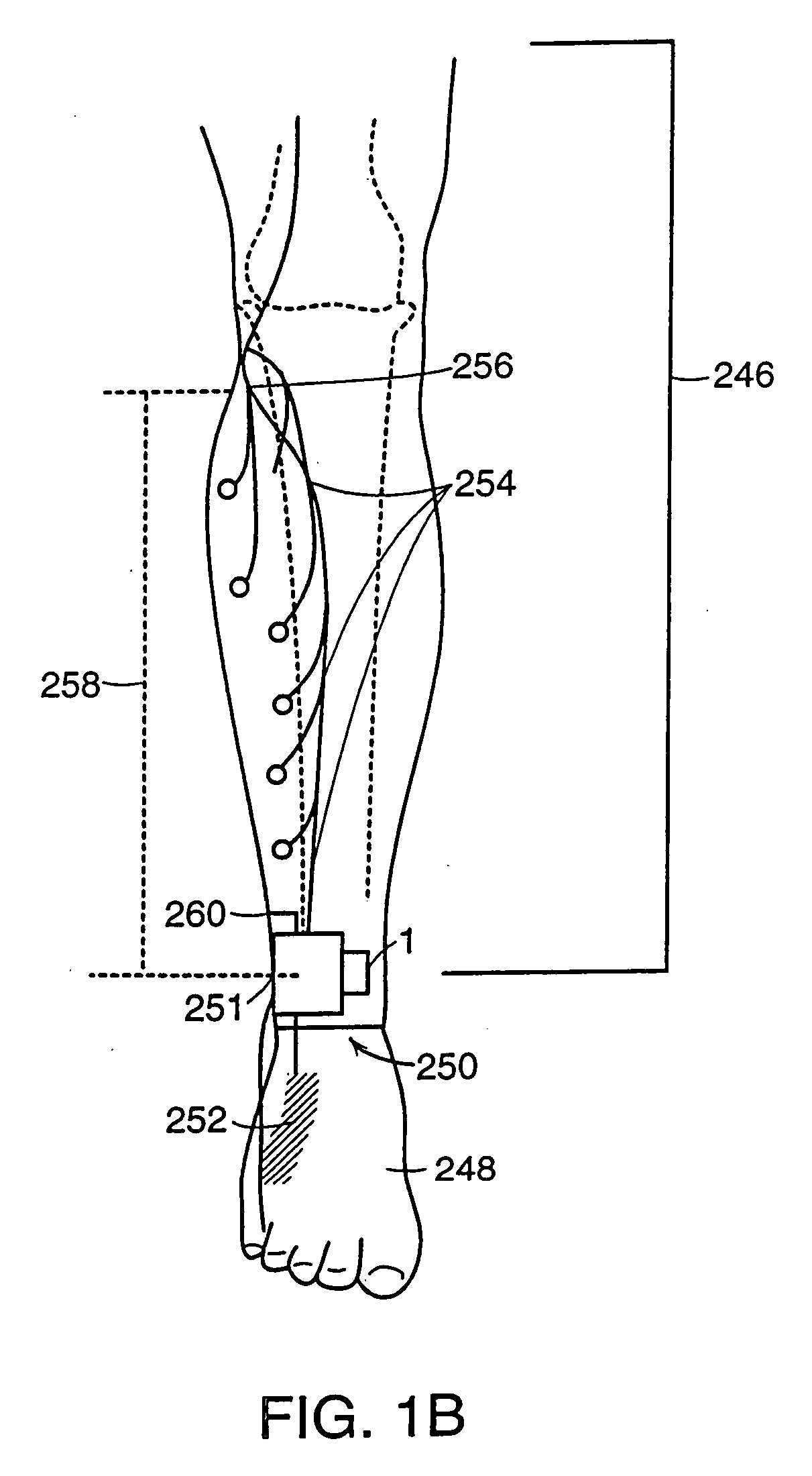 Methods for the assessment of neuromuscular function by F-wave latency