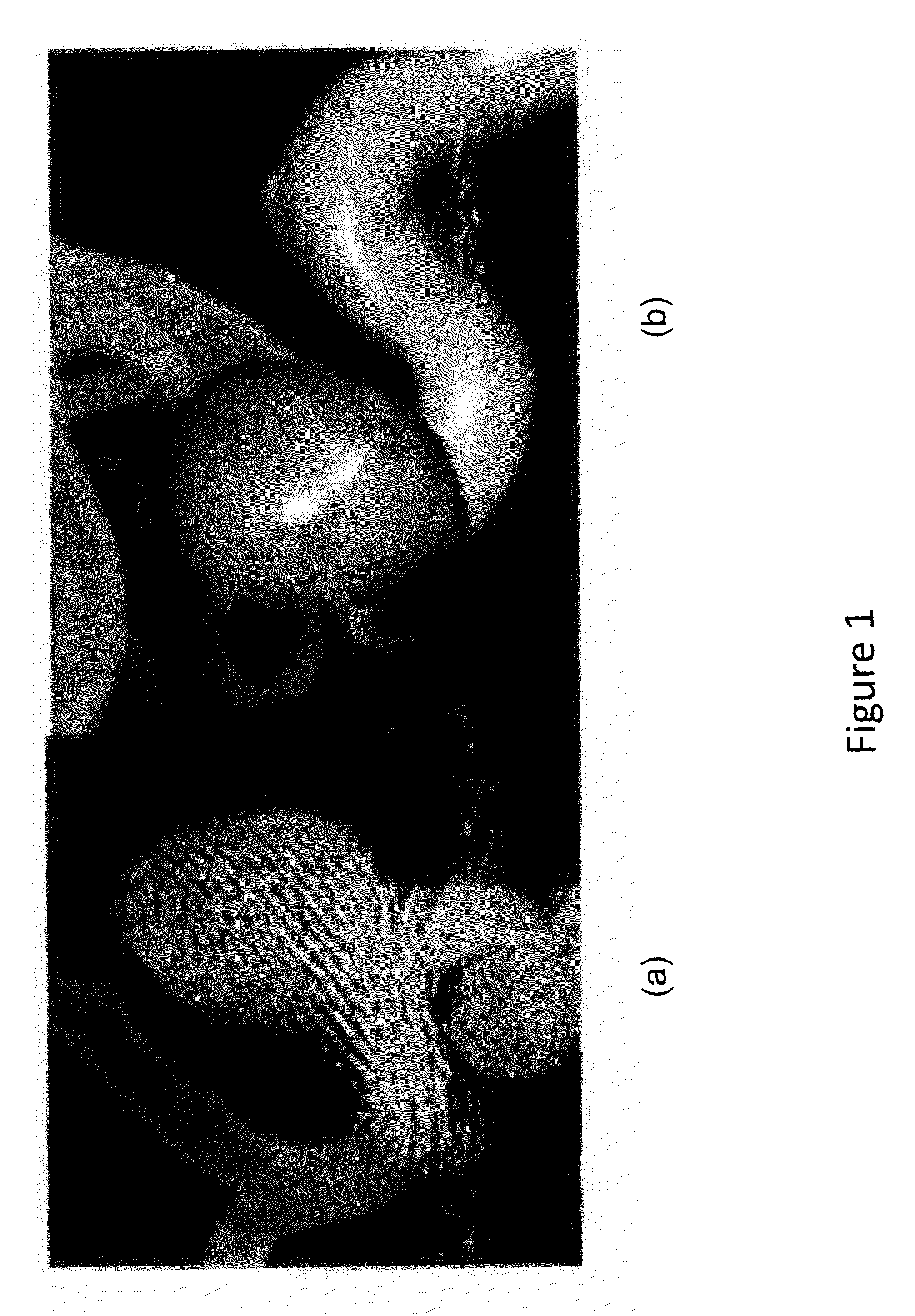 Method for vascular flow pattern analysis