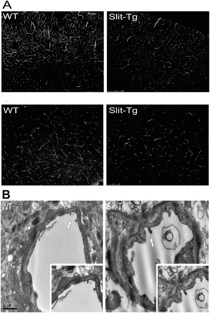 Construction method and application of transgenic animal with increased blood-brain barrier permeability