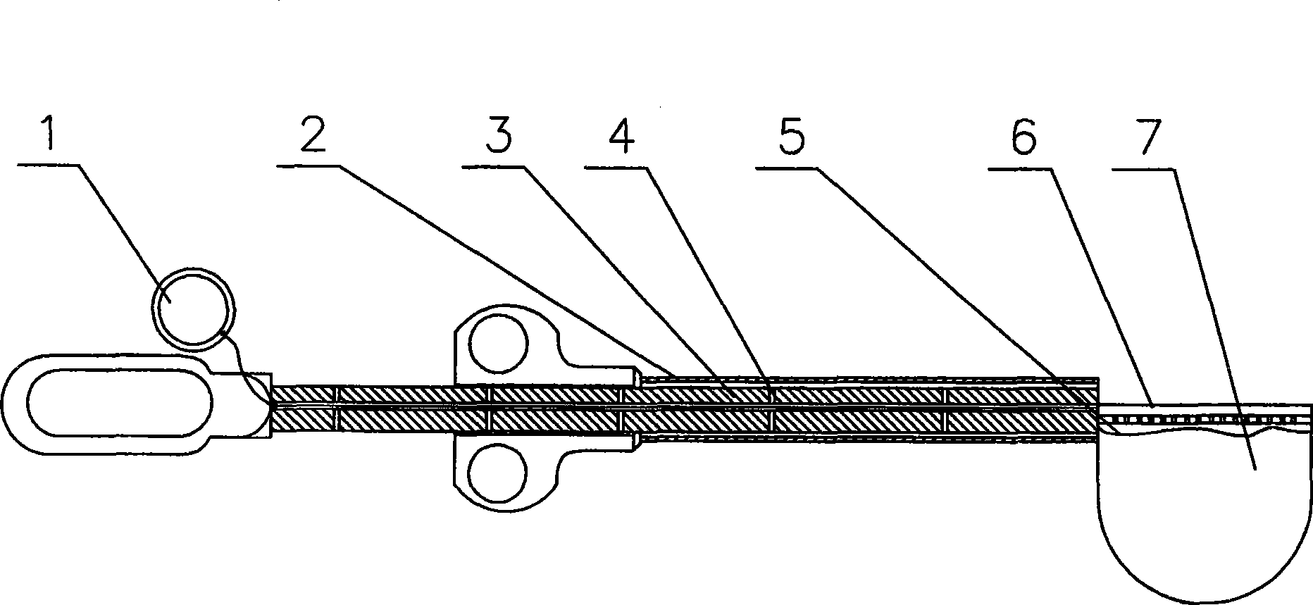 Fetching device of peritoneoscope