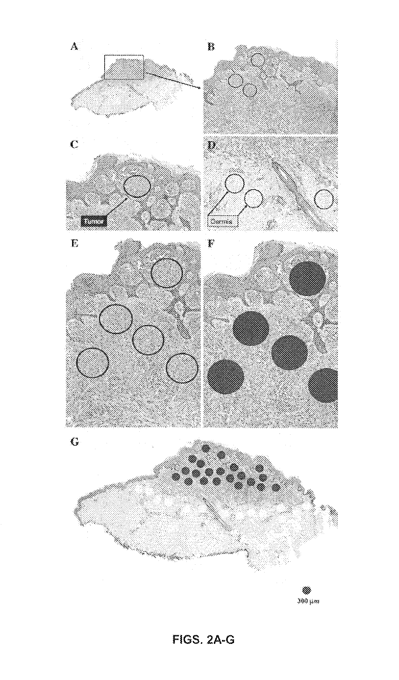 Method for differentiating spitz nevi from spitzoid malignant melanoma