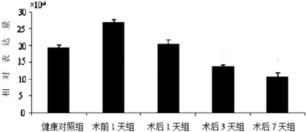 Application of hsa_circRNA_102032 to liver cancer diagnosis, treatment and prognosis