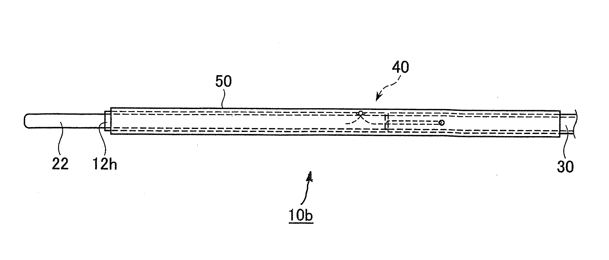 Stent kit