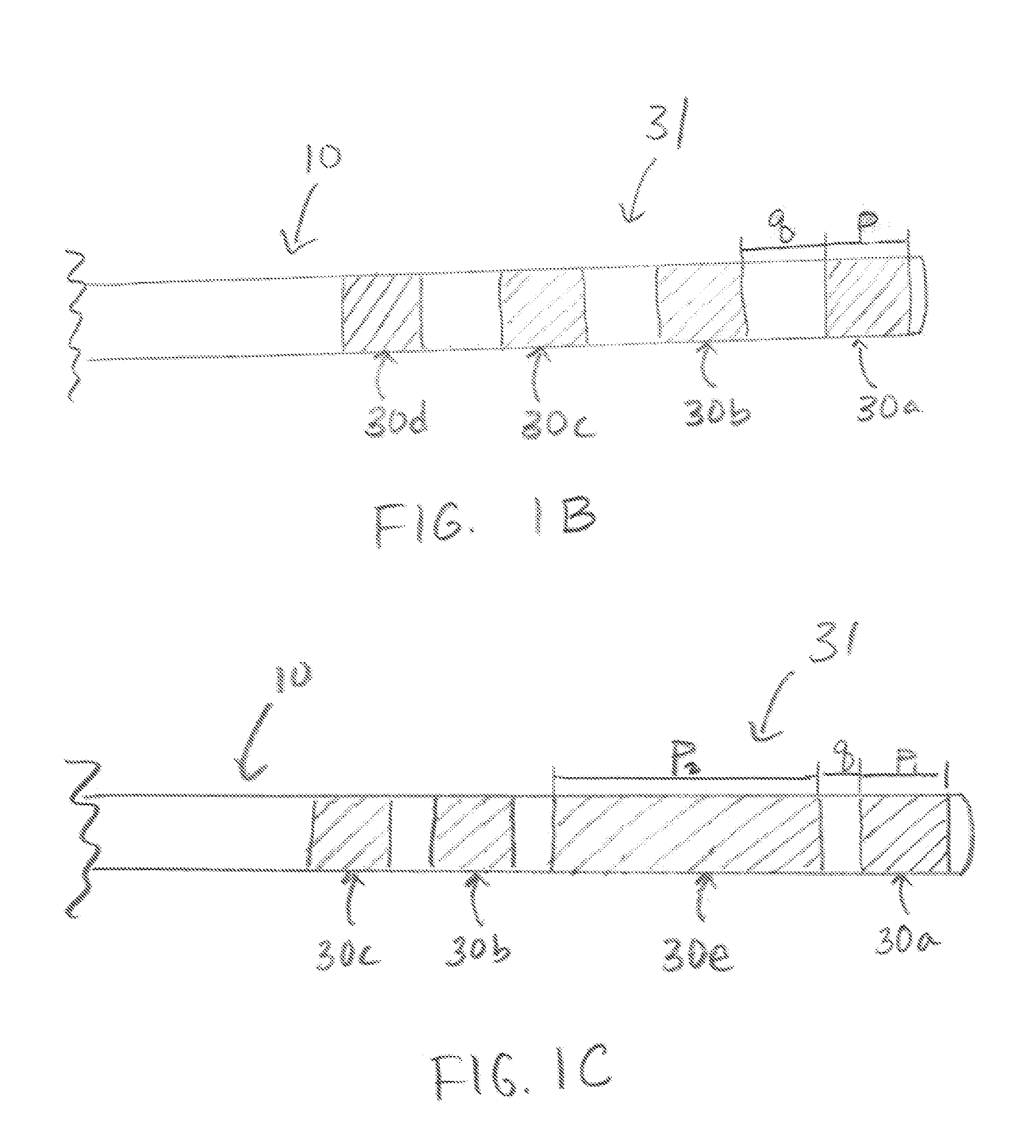 Implantable medical electrical stimulation lead fixation method and apparatus