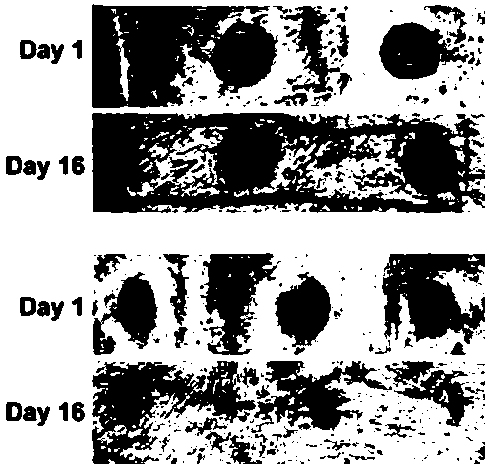 Biopolysaccharide material composition for treatment of oral mucosal ulcer in chemoradiotherapy patients