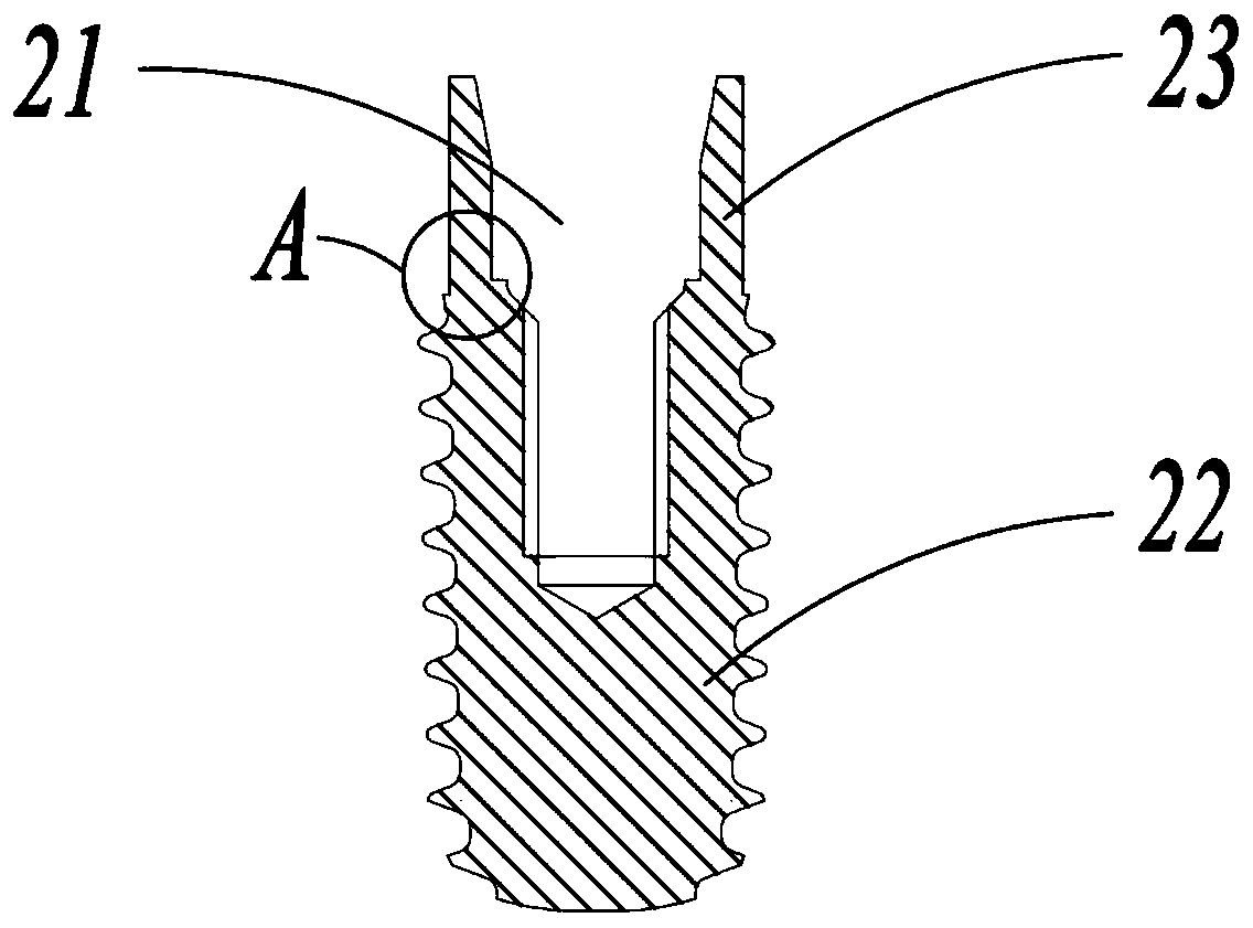 Dental implant system