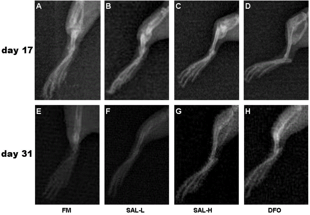 Use of salidroside in preparation of drug for promoting bone fracture repair