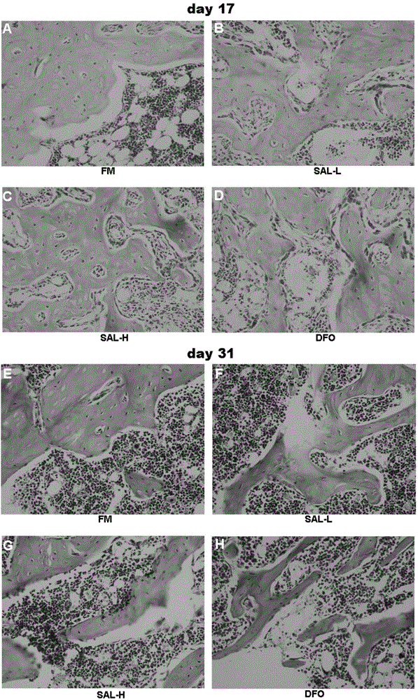 Use of salidroside in preparation of drug for promoting bone fracture repair