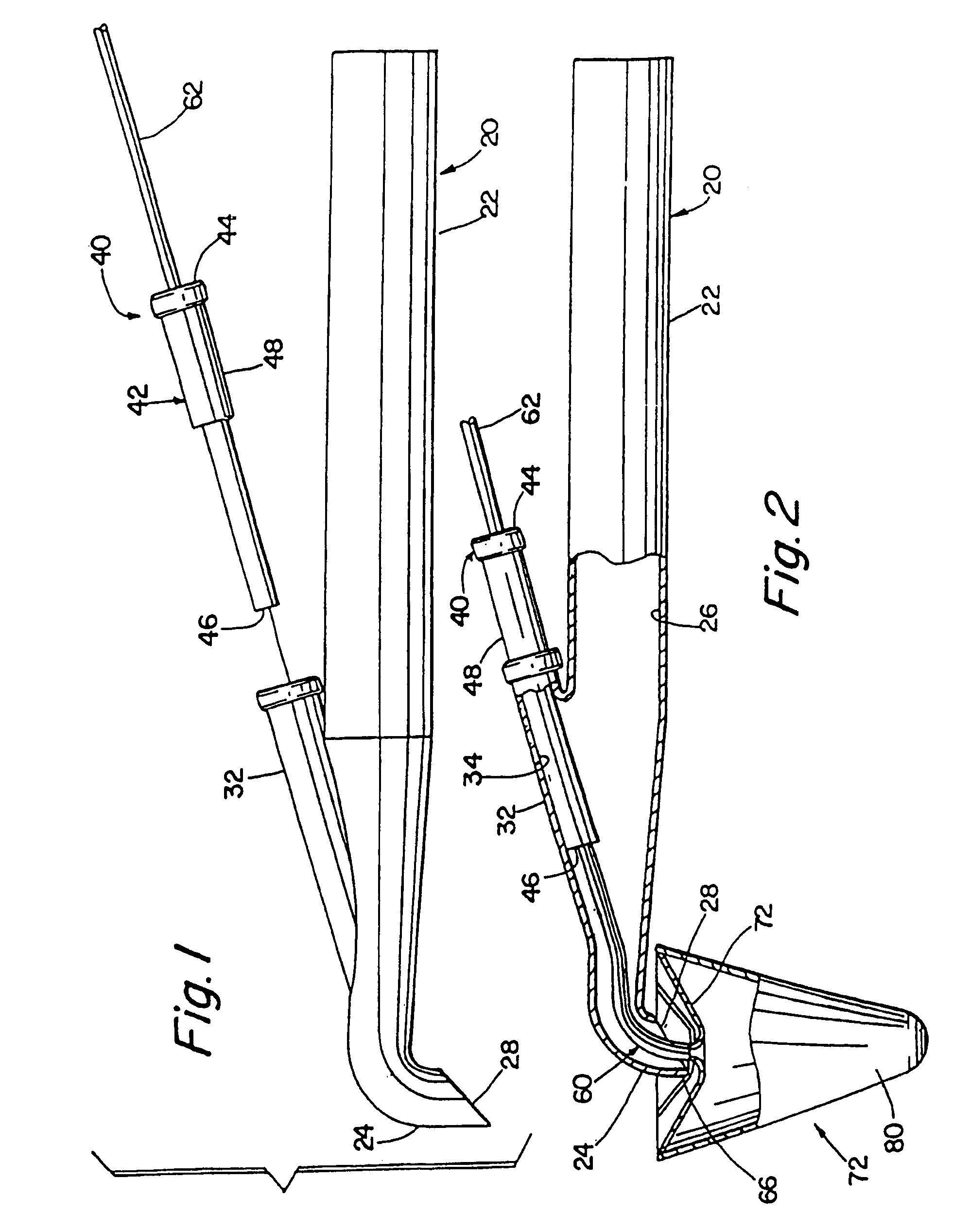 Adjustable blood filtration device