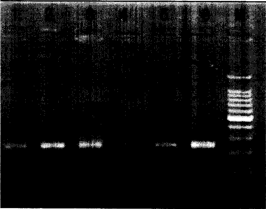 Method and reagent case for detecting hepatitis b virus anterior C/BCP region gene mutation