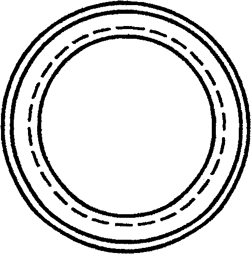 Expanding ring for treating glaucoma