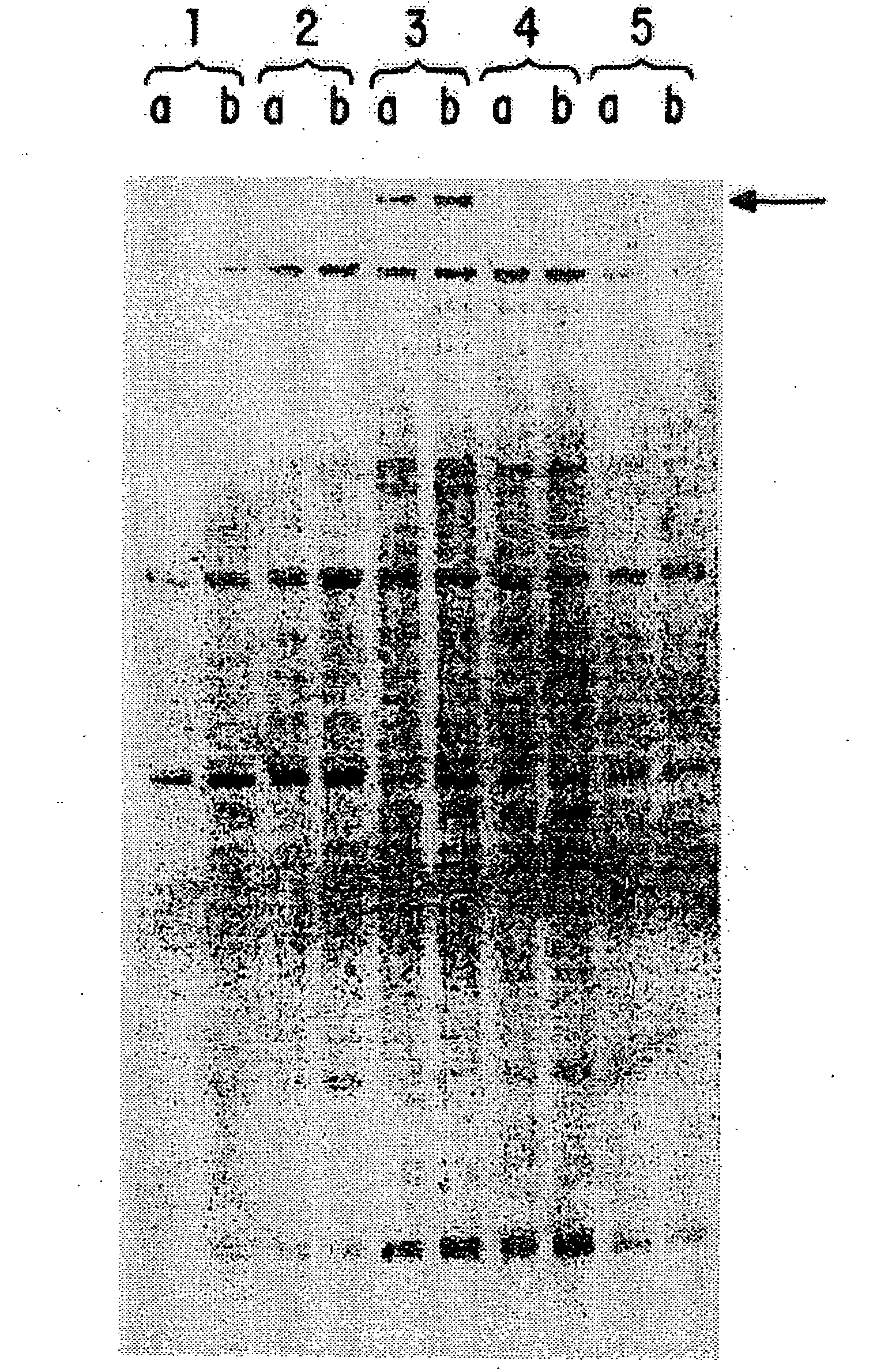 Compositions and methods for the treatment and diagnosis of immune disorders