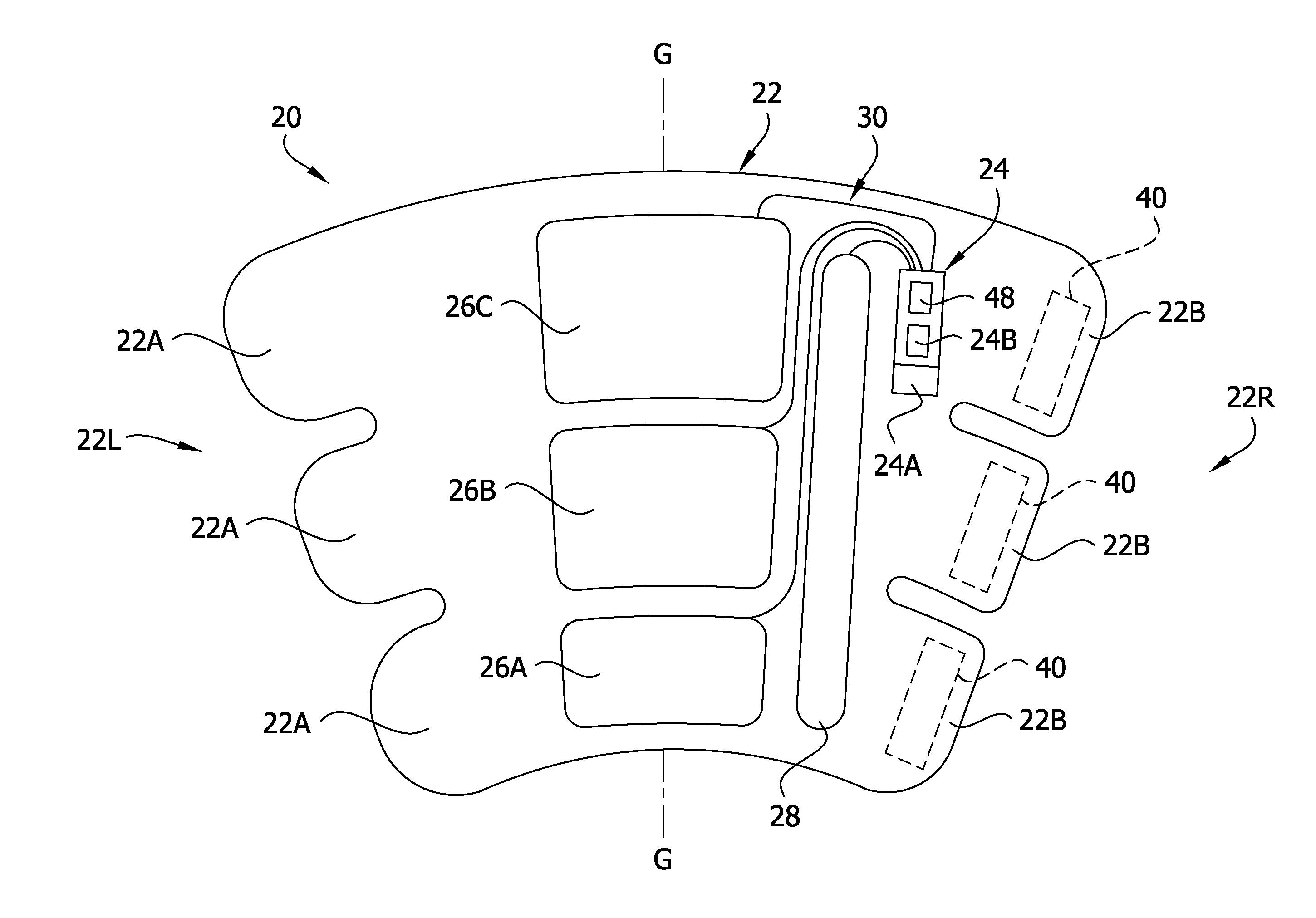 Compression garment apparatus having support bladder