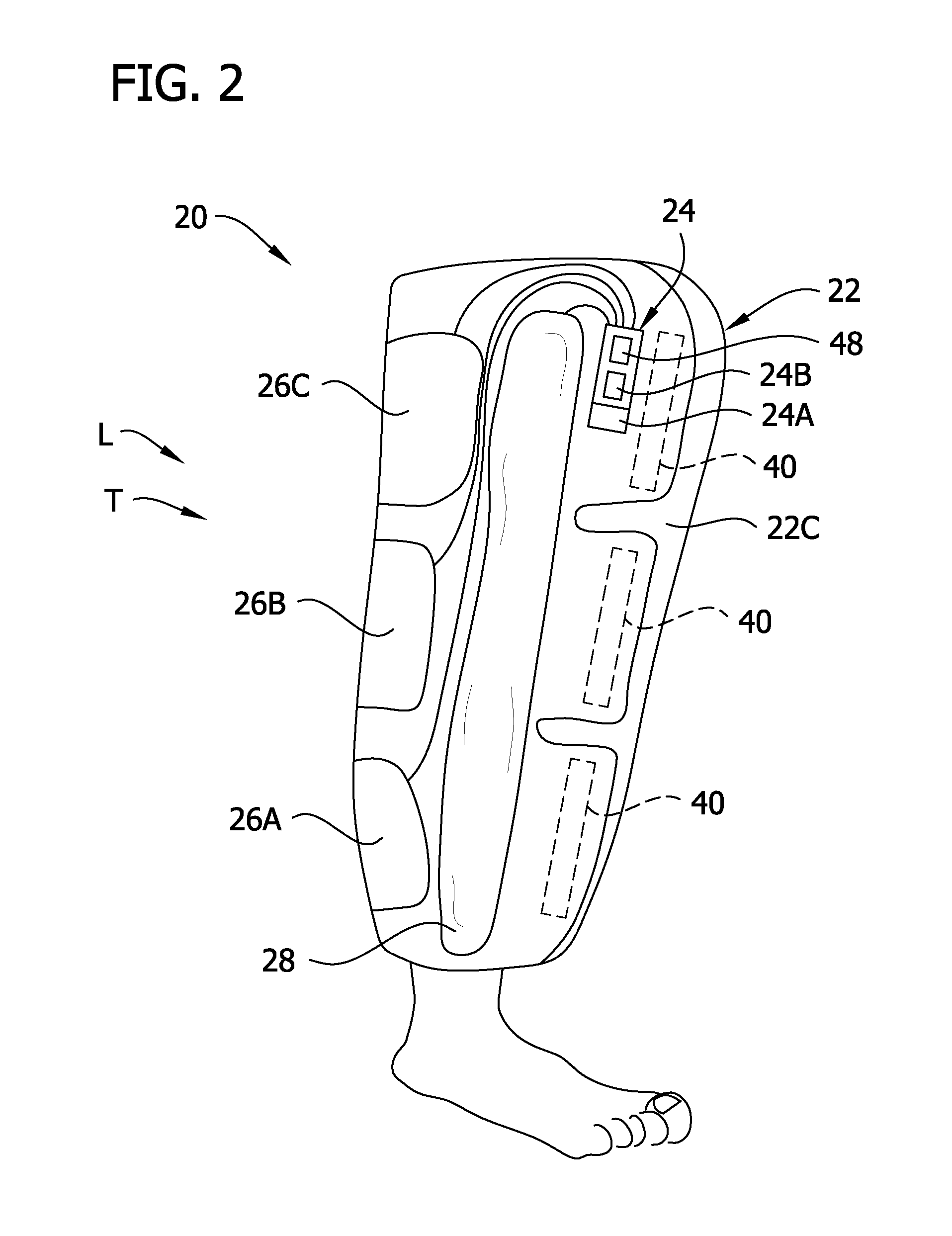 Compression garment apparatus having support bladder