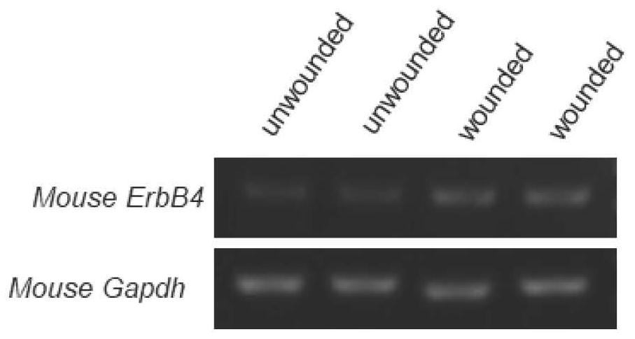 Method for promoting skin wound repair by neuregulin 1 and application of neuregulin 1