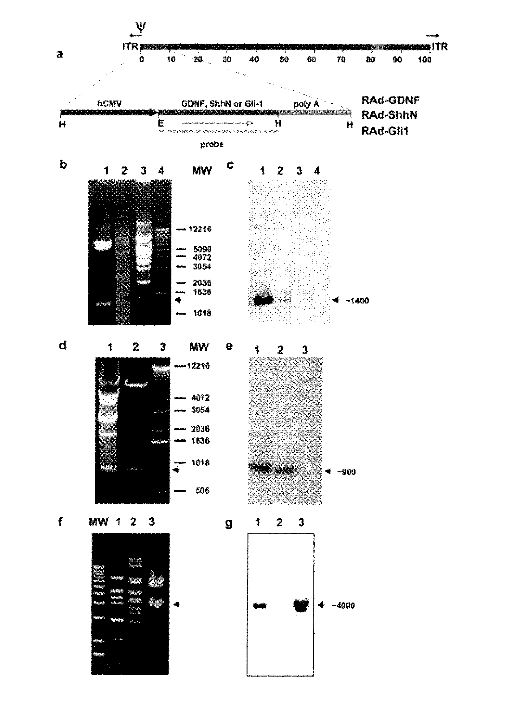 Treatment of parkinson's disease