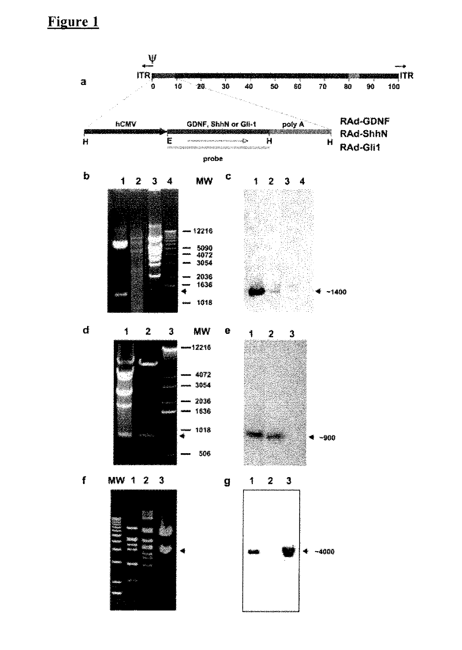 Treatment of parkinson's disease