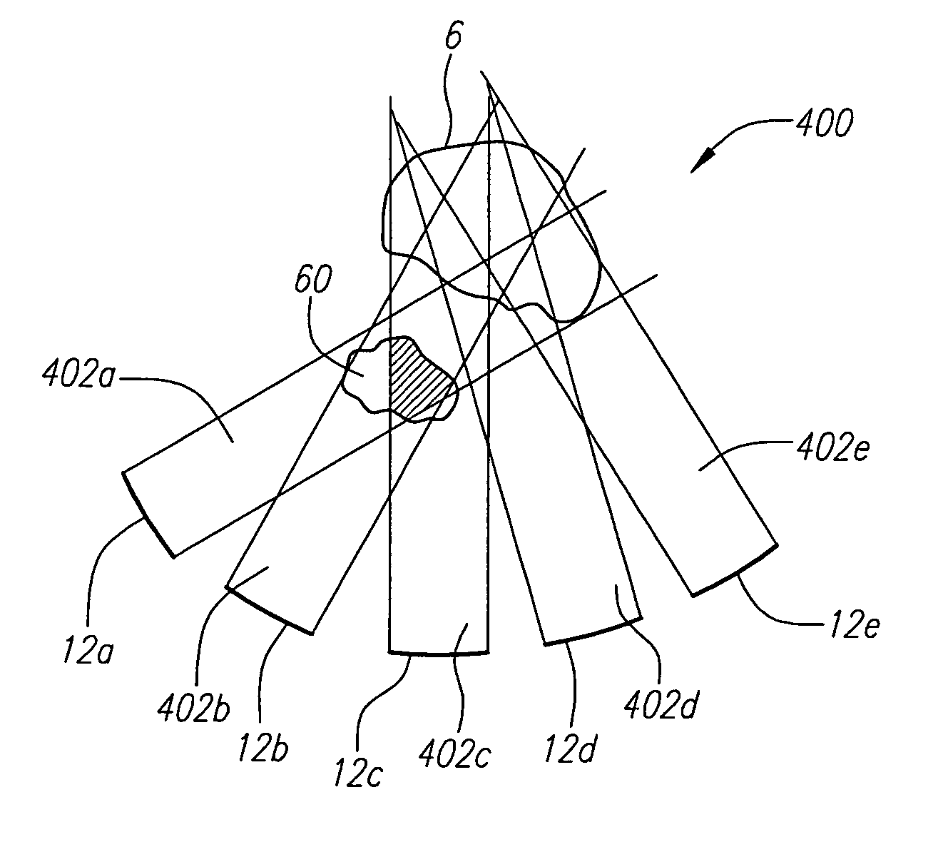 Focused ultrasound system with adaptive anatomical aperture shaping