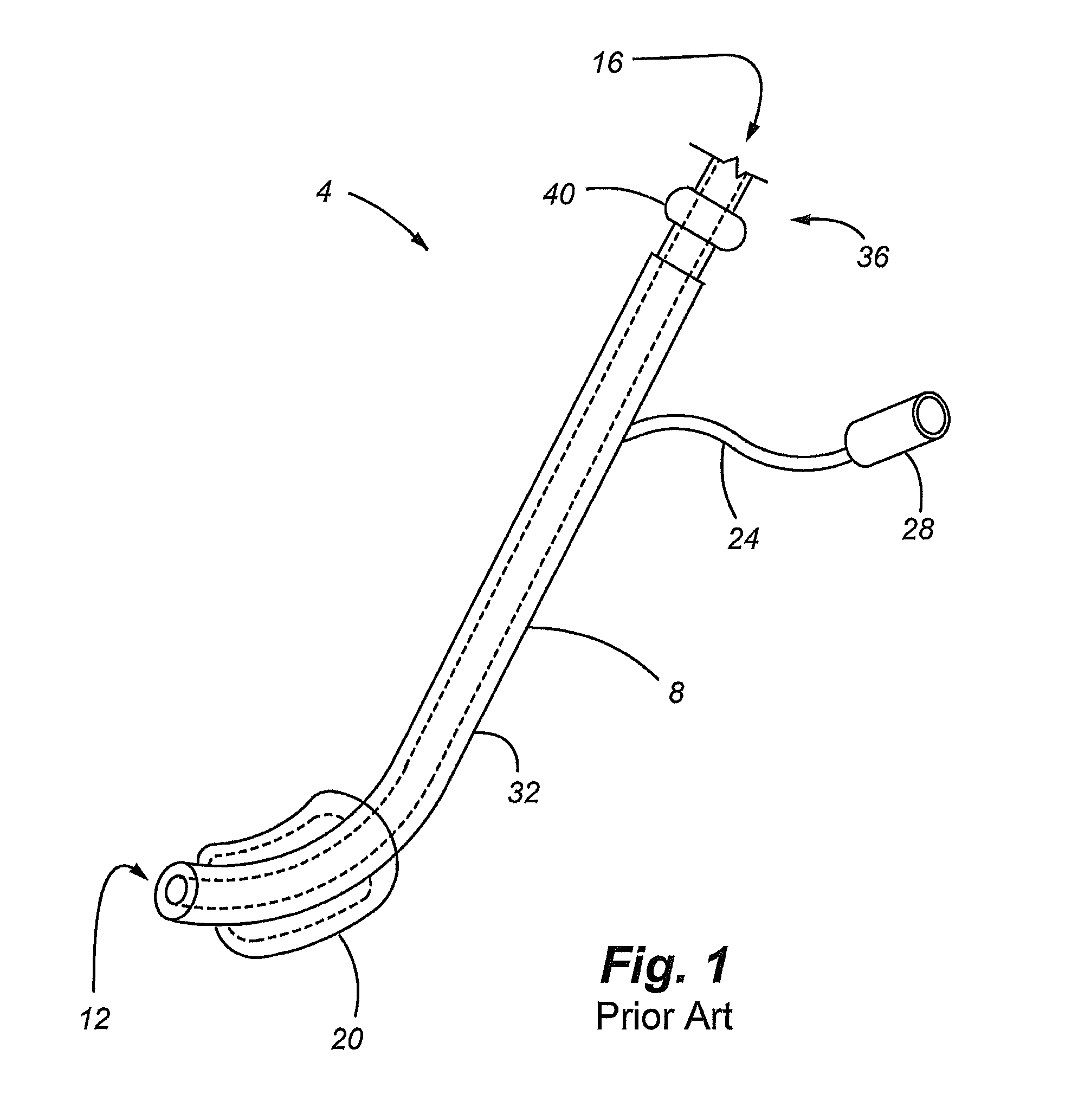 Modifications in endoscope apparatus, using fluid and gas dynamics, and methods for improving visibility during endoscopy