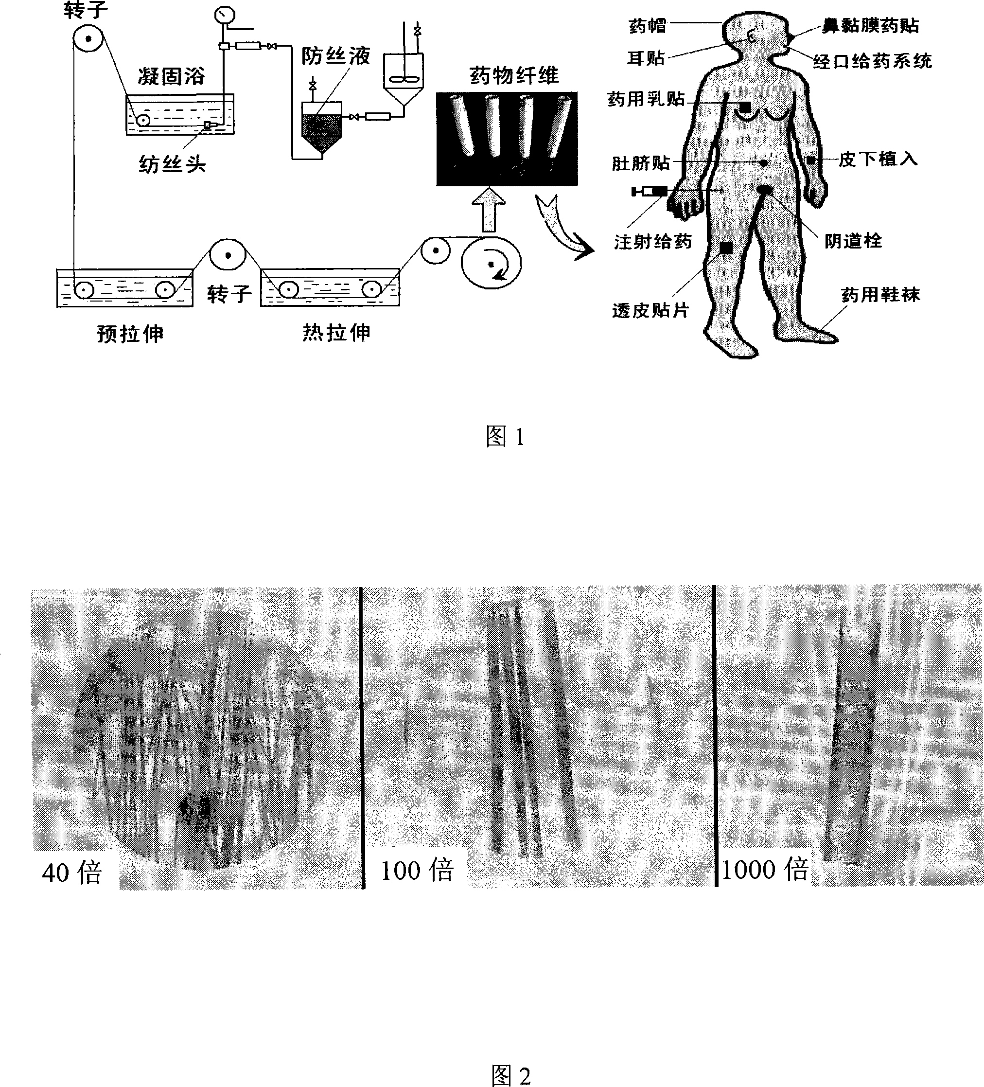 Long-acting medicine-loading orlon fibre capable of degrading partly, preparation and application thereof