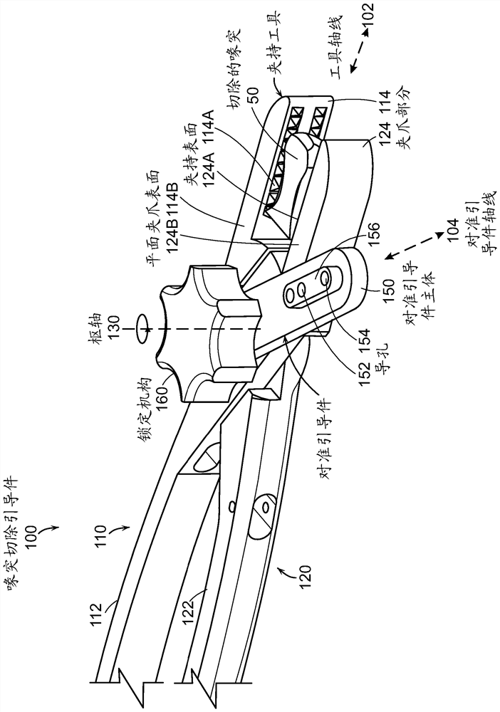 Open latarjet procedure for correction of anterior inferior glenoid bone loss