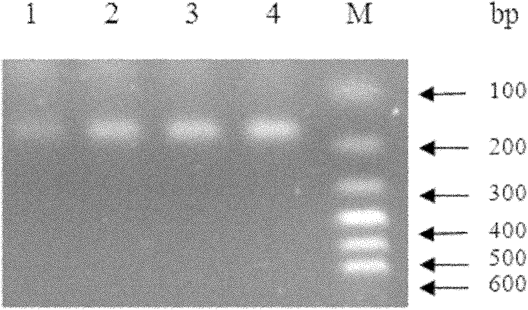 Recombinant chicken osteocalcin maturation protein monoclonal antibody and application thereof