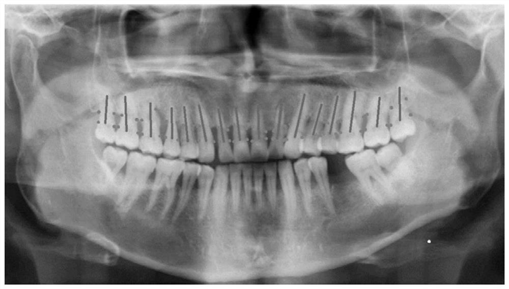 Tooth image processing method and device based on color clustering and electronic equipment