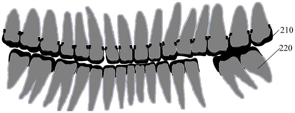 Tooth image processing method and device based on color clustering and electronic equipment