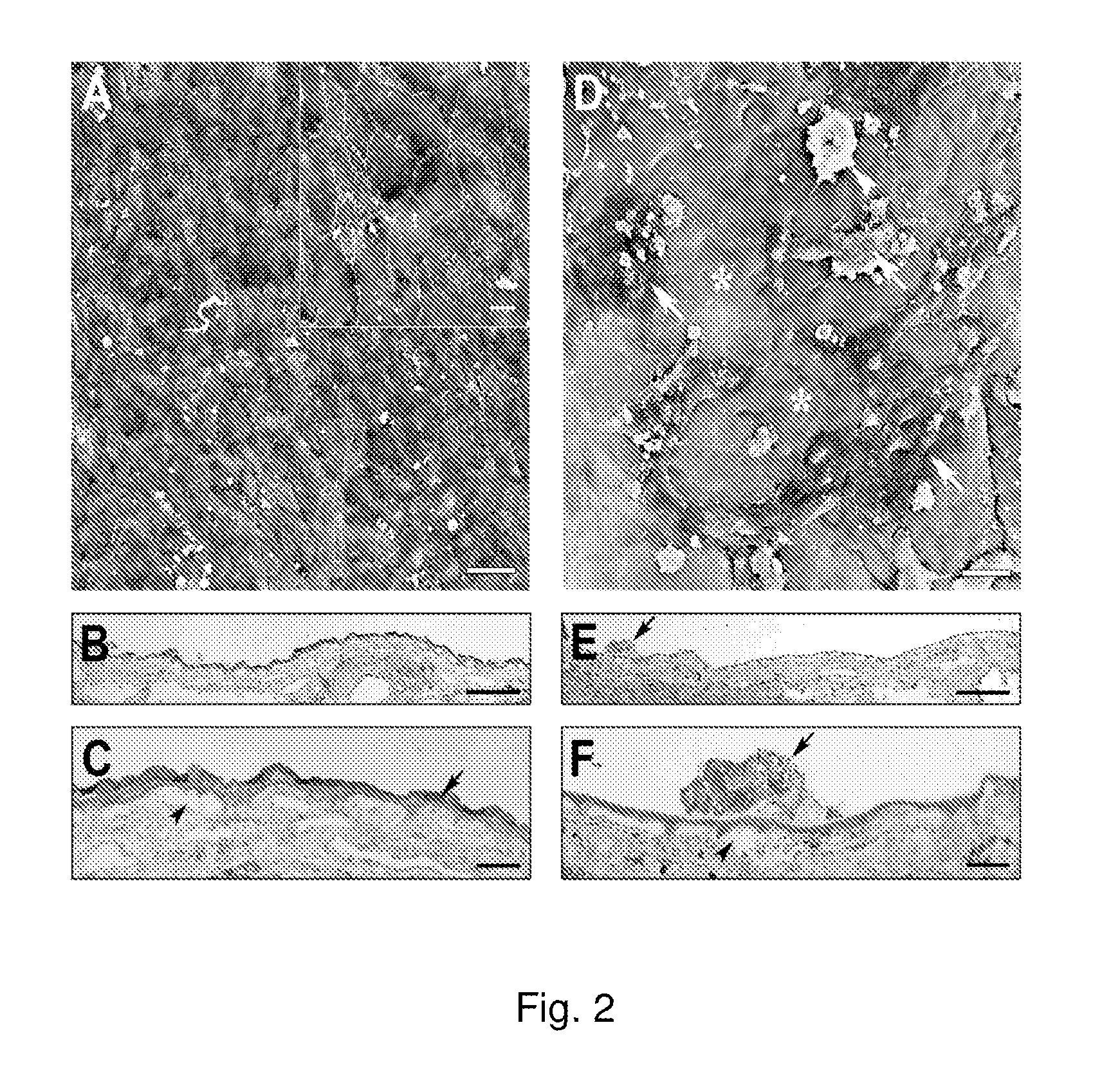 Production of extracellular matrix, conditioned media and uses thereof