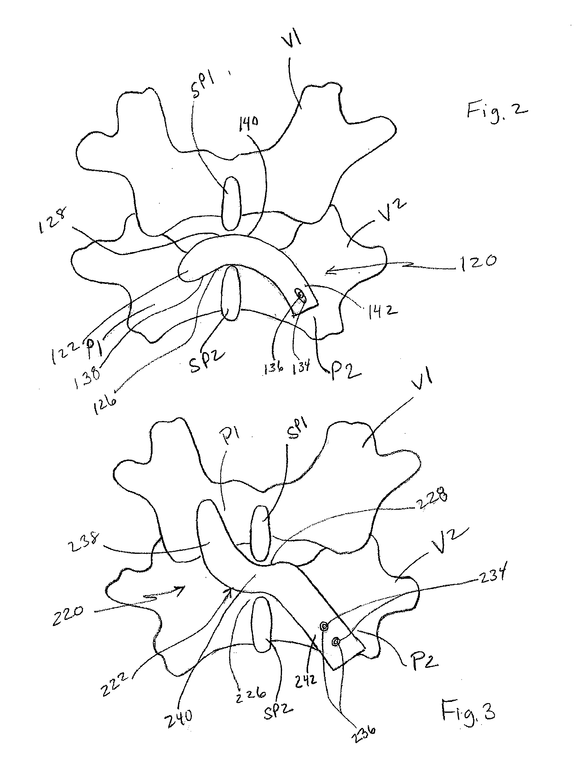 Spinous-process implants and methods of using the same