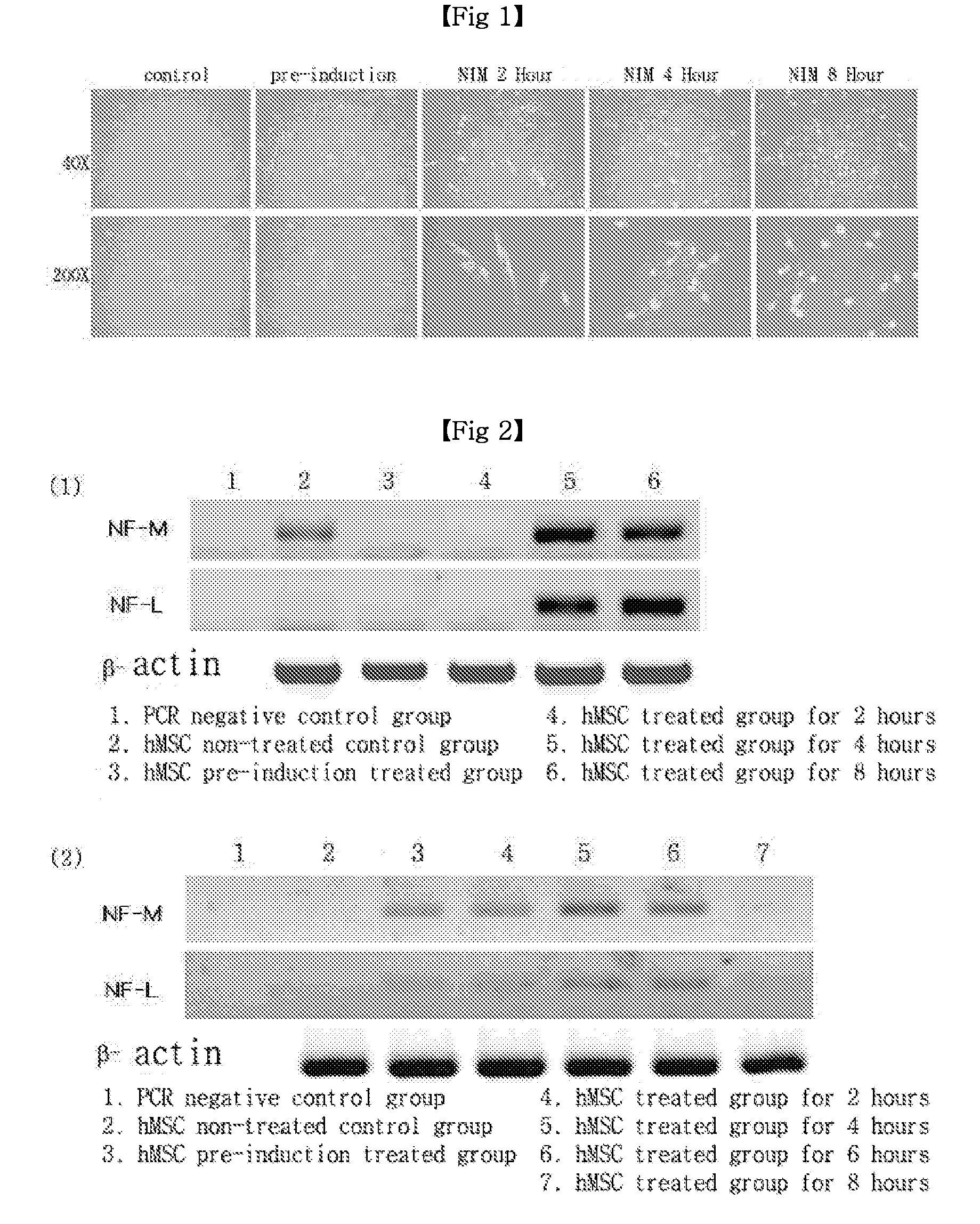 Method of inducing differentiation of mesenchymal stem cells into neurons