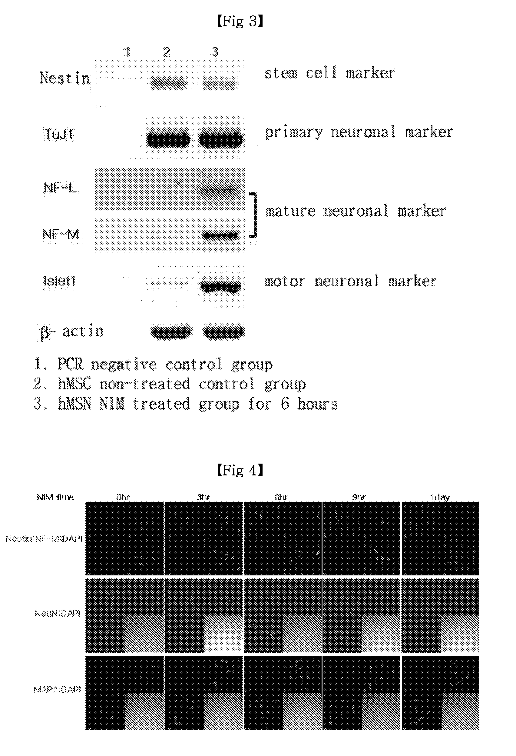 Method of inducing differentiation of mesenchymal stem cells into neurons